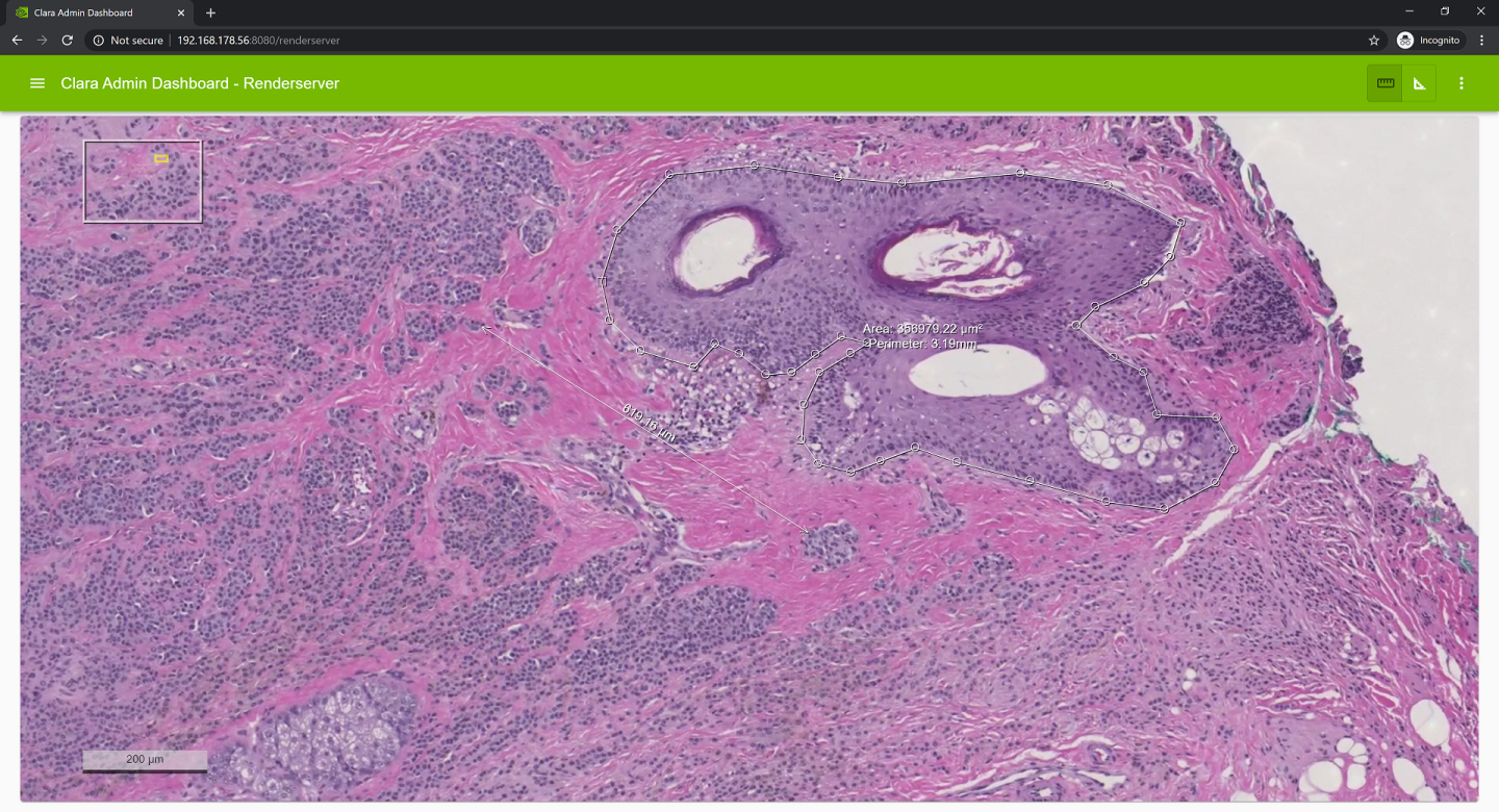 r6_ss_rsui_live_stream_digital_pathology_measure.png