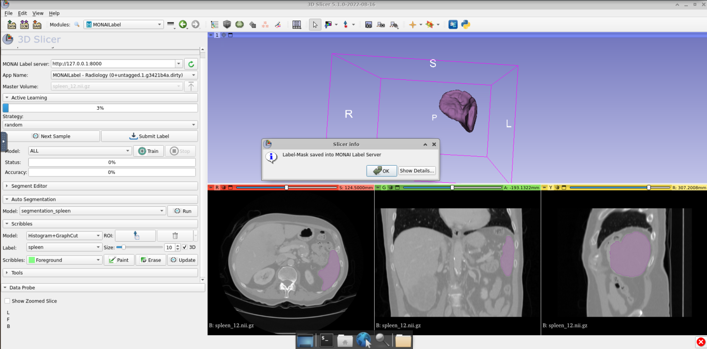 Unchanged Markup Position and Sequences - Support - 3D Slicer Community