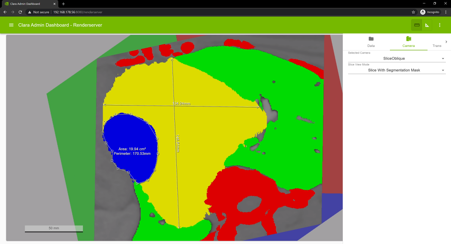 r7_ss_rsui_live_stream_oblique_slice_measure.png