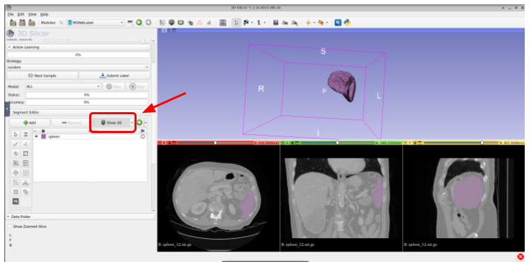 radiology-021.png