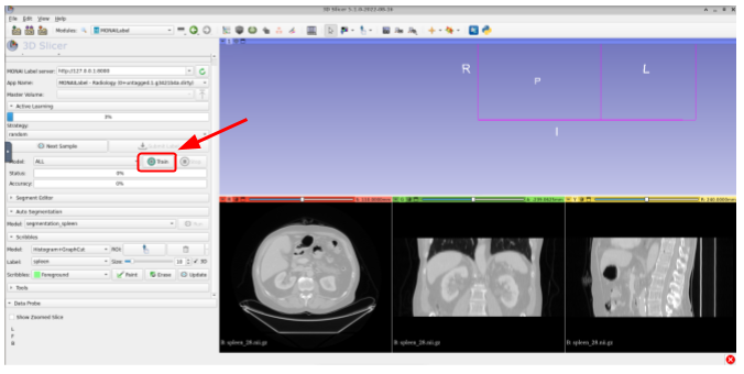 radiology-028.png