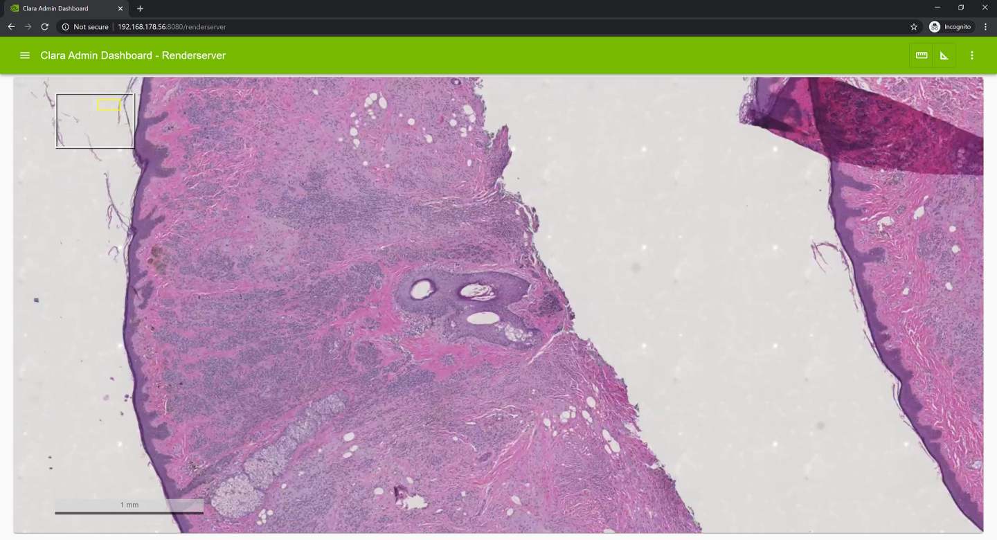 r6_ss_rsui_live_stream_digital_pathology.png