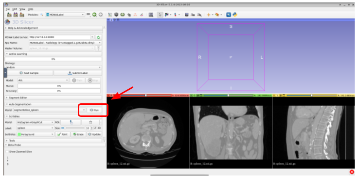 radiology-019.png