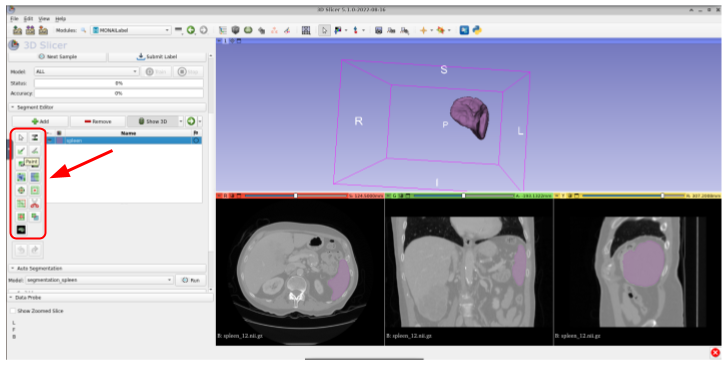 radiology-023.png